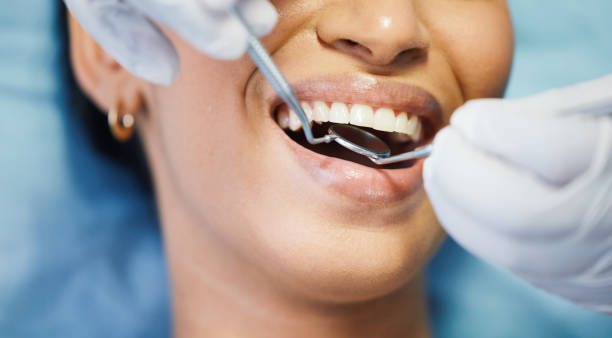 Best Emergency Dentist for Lost Fillings or Crowns in Lenox, IA